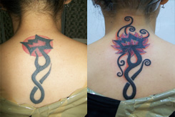 Cover-up Tattoo